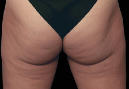 womans butt